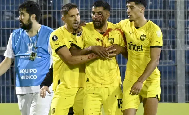 JUGADORHERIDO